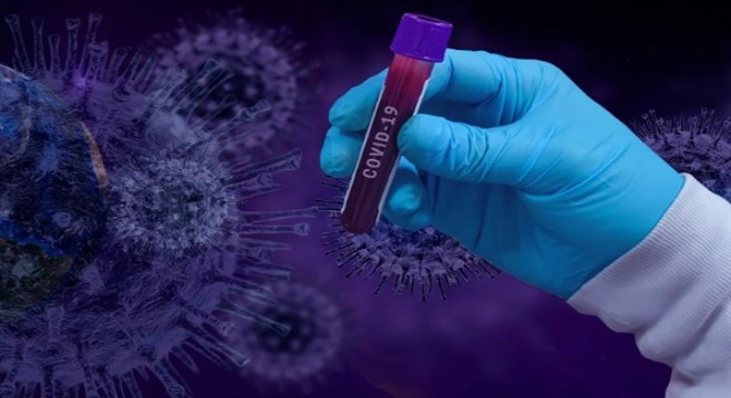 Koronavirüs salgınında ölenlerin sayısı 5 bin 765 e ulaştı