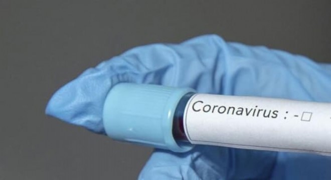 Türkiye ve dünyada koronavirüs gündemi: İşte son gelişmeler